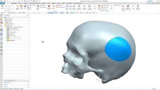 NX 11 amp Convergent Modelling  Cranial Implant [upl. by Diane-Marie]