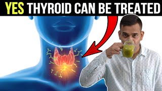 4 Easy Tips To Control Thyroid Issue  Cure Thyroid Problem IN 4 Natural Ways  Dr Vivek Joshi [upl. by Sirromal]