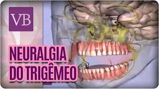 O que é Neuralgia do Trigêmeo  Você Bonita 180117 [upl. by Yevreh]