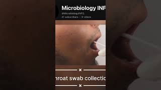 Throat swab specimen collection neet  studygram exam upsc ias biology studymotivation [upl. by Oratnek]