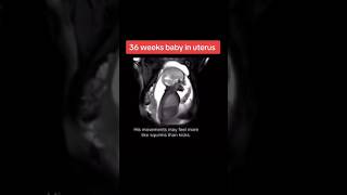 36 weeks baby in uterus pregnancy ultrasound🥰🥰🥰viralvideo trending baby [upl. by Yraeht]