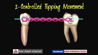 Types of Orthodontic Tooth movement [upl. by Llehsal]