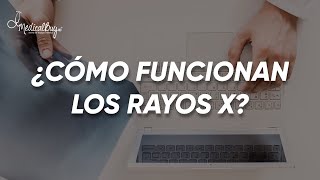 ¿COMO FUNCIONAN LOS RAYOS X [upl. by Ylrak]