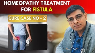 Fistula Cure Case No 2  Homeopathy Treatment for Fistula  Dr Abhik Ghosh Homeopathy [upl. by Mcclure]