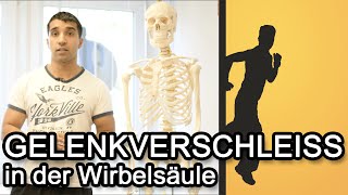 Gelenkverschleiss in der Wirbelsäule  Spondylarthrose  Facettengelenksyndrom [upl. by Plafker568]