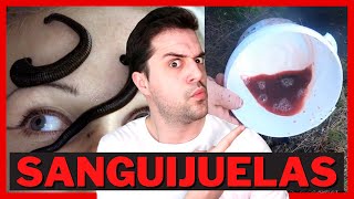 ⚠️¡CUIDADO con las Sanguijuelas⚠️ [upl. by Linus]