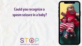 Could you recognize a spasm seizure in a baby [upl. by Candida171]