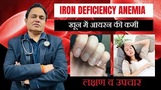 Iron deficiency anemia l iron ki kami ko kaise dur kare l iron deficiency symptoms l Dr Mohit Vohra [upl. by Aciemaj]