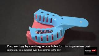 Impression Techniques for Implant Dentistry  Step by Step Open tray Impression technique [upl. by Ettelliw]