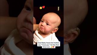 Deaf baby hears for the first time🥺♥️ shorts [upl. by Down]