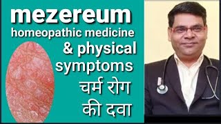 Mezereum 30  Mezereum 200  Mezereum 1m  mezereum homeopathic medicine uses in hindi [upl. by Schofield436]