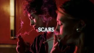 Scars Slowed  Reverb  Ap Dhillon [upl. by Nymassej]