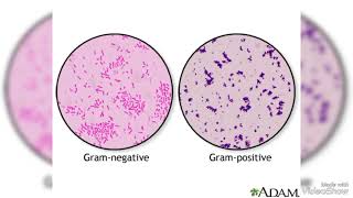 Difference between Gram positive and Gram negative [upl. by Keldah81]