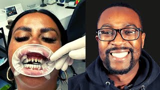 Turkey Teeth Nightmare DENTIST REACTS  Unable to sleep after dental procedure abroad [upl. by Erfert]