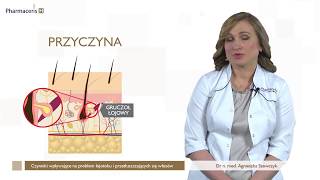 Przyczyny nadmiernego przetłuszczania się włosów – dr Agnieszka Szewczyk [upl. by Kellyann]