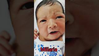 Miliariababyshorts babyvideos [upl. by Nitaf]