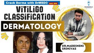 Vitiligo classification  Segmental  Nonsegmental  Acrofacial  Universal  Dr Maddineni Srinivas [upl. by Vedi466]