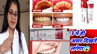 Yayashi Sp4 Toothpaste Honest Review  Yayashi Sp4 toothpaste benefits uses review in hindi [upl. by Shoshana]