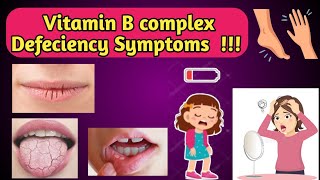 Becosules Capsules Khane Ke Fayde  B Complex Forte With Vitamin C Capsule  बीकोस्यूल्स कैप्स्यूल्स [upl. by Ailaham]