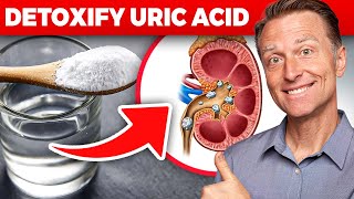 The Ultimate Kidney Cleanse for Uric Acid and Gout Dr Bergs Proven Techniques [upl. by Nosac]