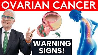 Ovarian Cancer Warning Signs Dr Gundry Wants YOU To Know [upl. by Eahsal]