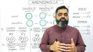 Genetics of Haemophilia UrduHindi medium profmasoodfuzail Types of Haemophilia [upl. by Jorry]