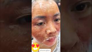 Get Spotless amp Glowing Skin  Remove Dark Spots amp Pigmentation In 7days beautiful shorts viral [upl. by Duster]