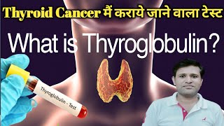 थायरोग्लोबुलिन टेस्ट क्या है  Thyroglobulin Test in Hindi  थायरोग्लोबुलिन टेस्ट क्यों किया जाता है [upl. by Maleki]