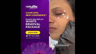 Naturals Salon Wellawatte  Warts Removal Package 💜 [upl. by Hamfurd627]