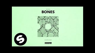 DOD  Bones Official Audio [upl. by Eelrahc]