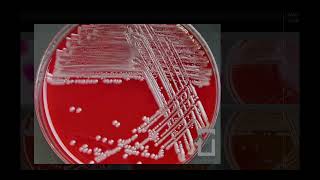 Achromobacter xylosoxidans  Microbiology [upl. by Katee]