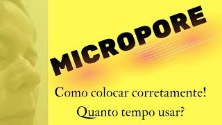 Micropore  Rinomodelação Definitiva [upl. by Heyman461]