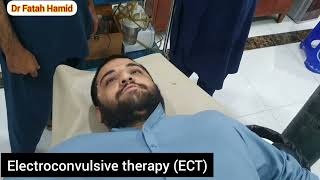 Electroconvulsive therapy ECT foryou foryourpage millions medical [upl. by Nino]