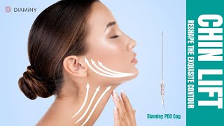 Do you know what the double chin lift procedure is Cheek lift foxeye lift with Diaminy cog thread [upl. by Lolande]