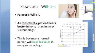 ENT Paracusis Willisii Ear Otospongiosis Otosclerosis Hear better loud speak outside home [upl. by Swec]