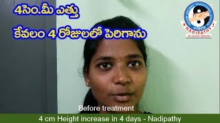 4 cm Height increase in 4 days Nadipathy treatment [upl. by Aylward320]