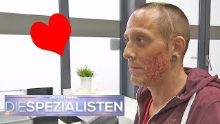 Herzförmige Verbrennung im Gesicht wie ist das passiert  Die Spezialisten  SAT1 TV [upl. by Atinek]