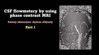 MRI CSF flowmetery part 1 👉 anatomy and physiology [upl. by Aisetra]