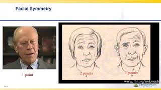 National Institutes of Health Stroke Scale  Lisa Klein [upl. by Collier]