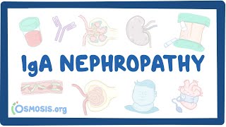 IgA nephropathy  causes symptoms diagnosis treatment pathology [upl. by Galloway]