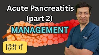 Acute Pancreatitis को कैसे manage करें। Acute Pancreatitis treatment in hindi [upl. by Suivart]