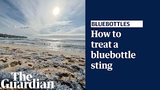 What to do if you get stung by a bluebottle explained by a lifesaver [upl. by Kus]