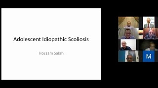 Adolescent Idiopathic Scoliosis  Prof Hossam Salah [upl. by Aer547]