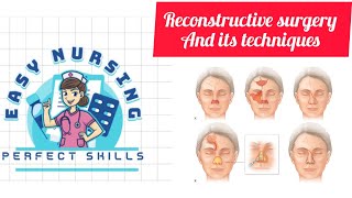 Reconstructive surgery and its techniques 4th sem [upl. by Edita]