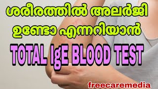 Allergy test malayalam total IgE blood test allergies allergy allergytreatment bloodtest [upl. by Gneh227]