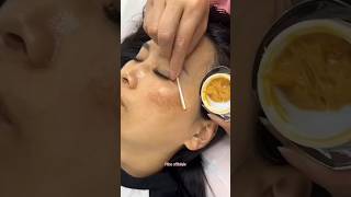 Remove Dark Spots amp Pigmentation Naturally At Home  Get Glowing Skin skin beautiful shorts [upl. by Aken]