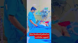 live treat patients on ventilator support ajeetsingh medical ki duniya short [upl. by Orland]