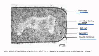 223 Identify structures in electron micrographs of Ecoli [upl. by Nodnab]