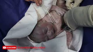 Special newborn baby with high weight the moment after delivery viral baby cute [upl. by Aivle]