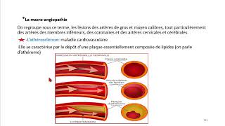 Cours dEndocrinologie vidéo 9  Pathologie de léquilibre glycémique [upl. by Alfredo337]